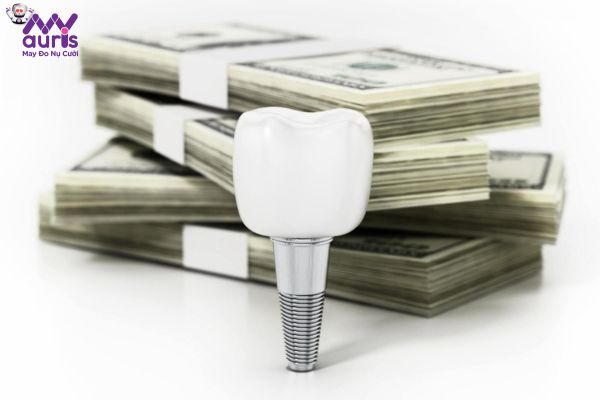 Có nên thực hiện trồng răng Implant mức giá rẻ không?