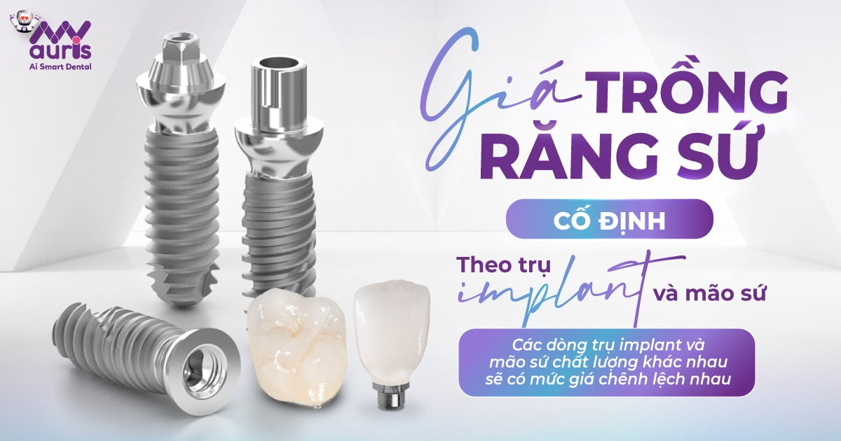 gia-trong-rang-su-co-dinh-theo-tru-implant-va-mao-su