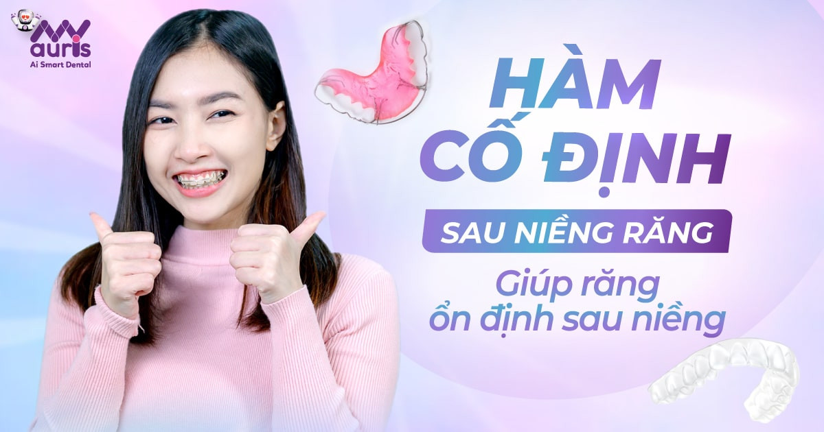 Hàm cố định sau niềng răng những lưu ý trước khi sử dụng