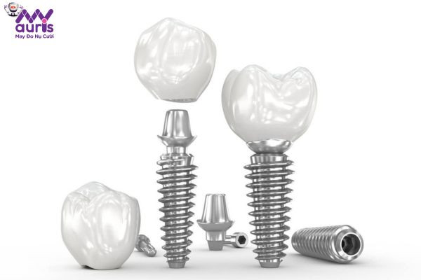 Lưu ý khi chọn khớp nối Abutment trong điều trị trồng răng Implant 