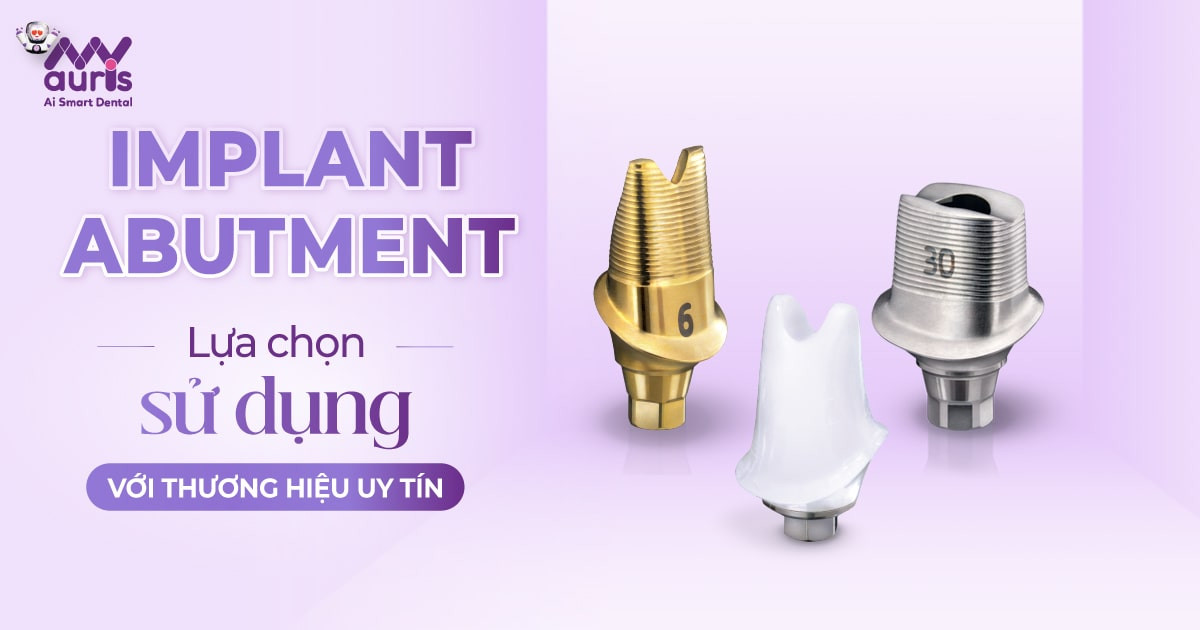 Implant Abutment nên chọn của thương hiệu nào?