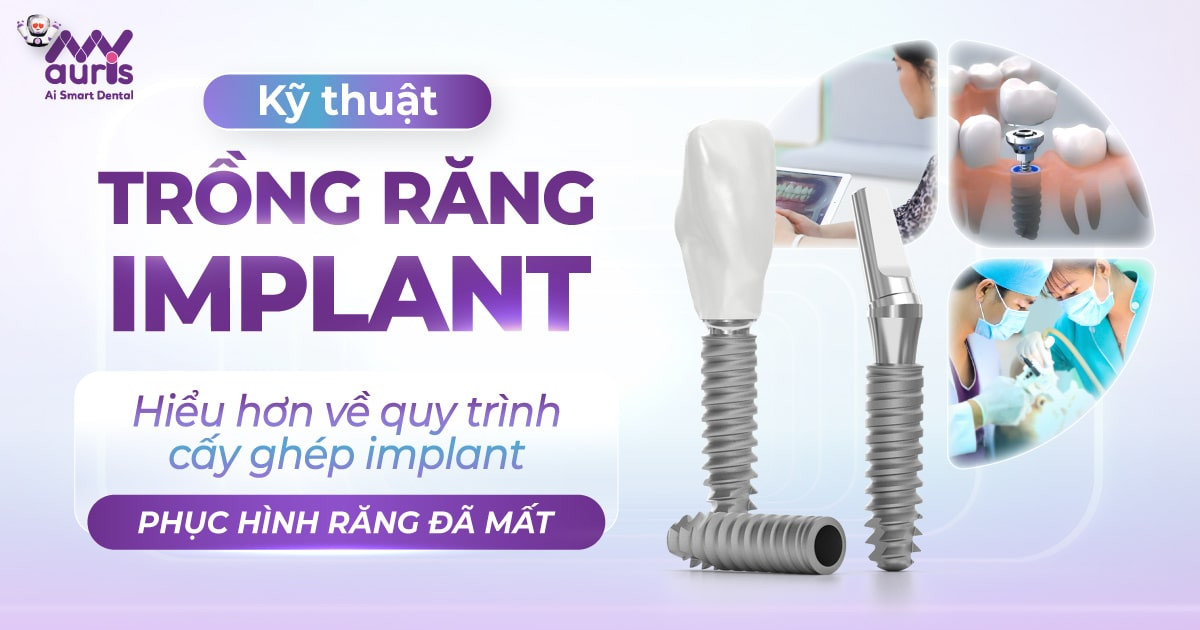 ky-thuat-trong-rang-implant-quy-trinh-thuc-hien