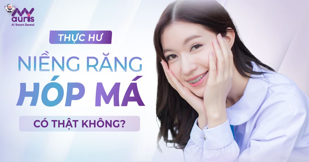 niềng răng má hóp