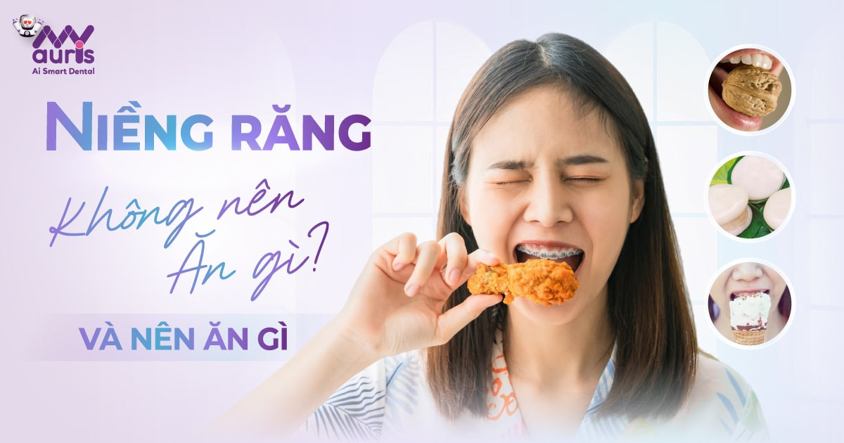 Niềng răng không nên ăn gì? 5 loại đồ ăn cần tránh xa