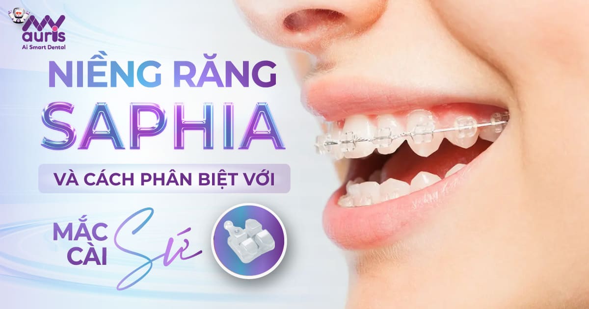 niềng răng saphia