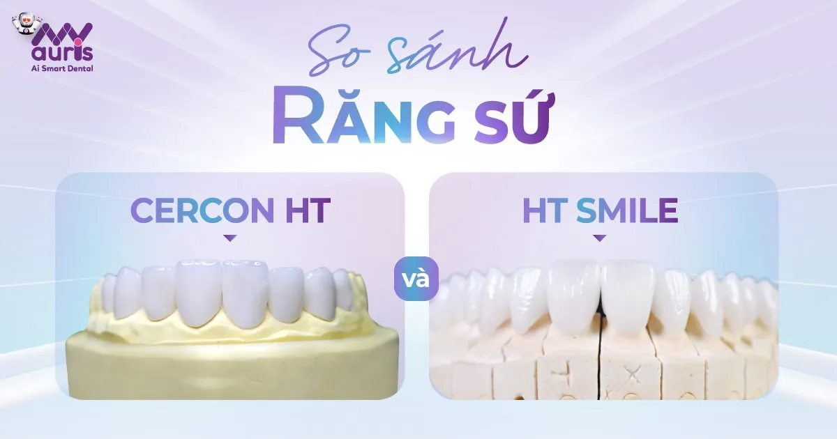 So sánh răng sứ Cercon HT và HT Smile trong điều trị