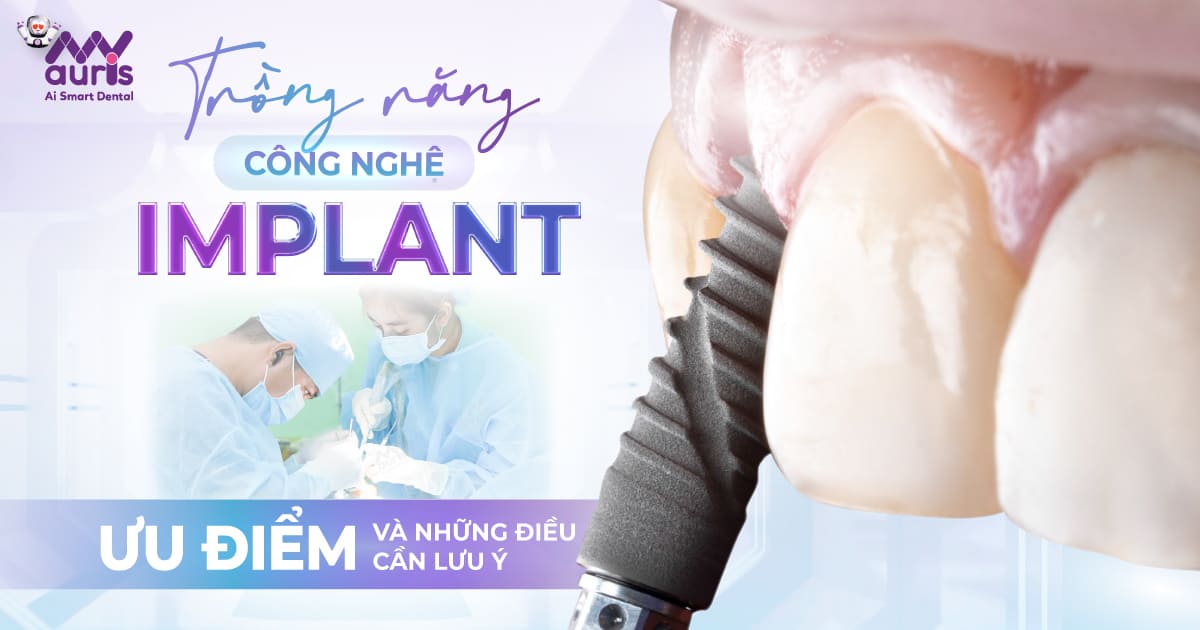 Trồng răng công nghệ implant