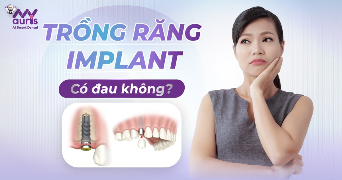 Trồng răng Implant có đau không? 4 yếu tố ảnh hưởng