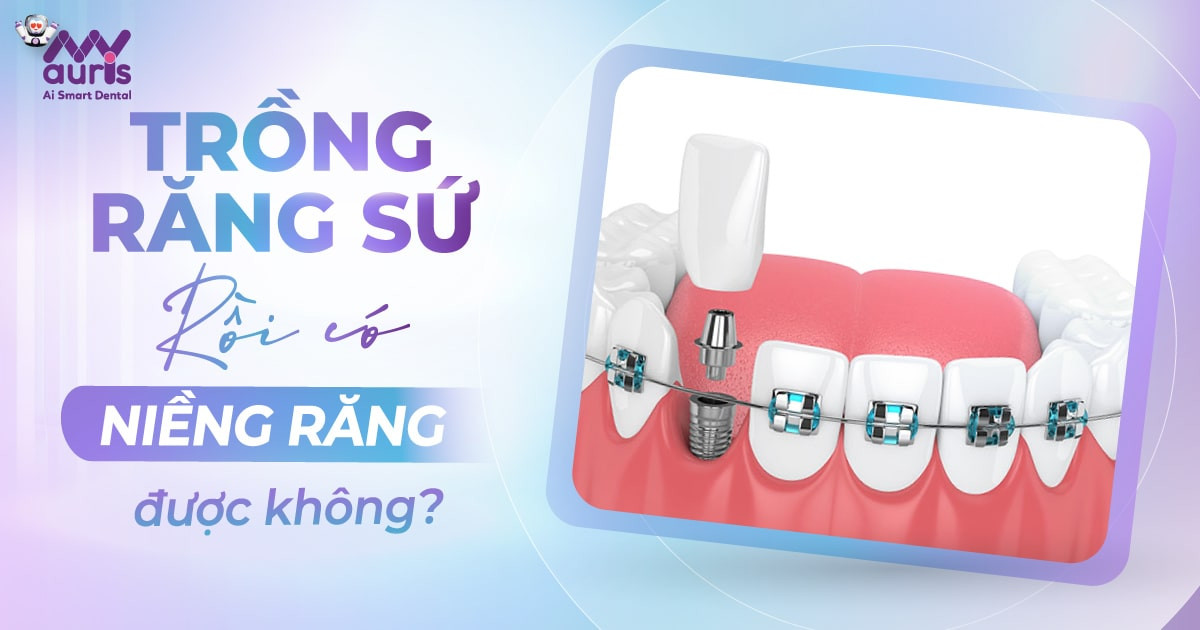 [Giải đáp] Trồng răng sứ rồi có niềng răng được không?