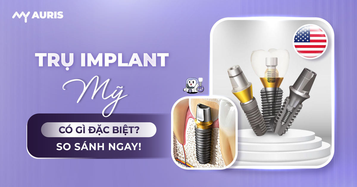 trụ implant mỹ