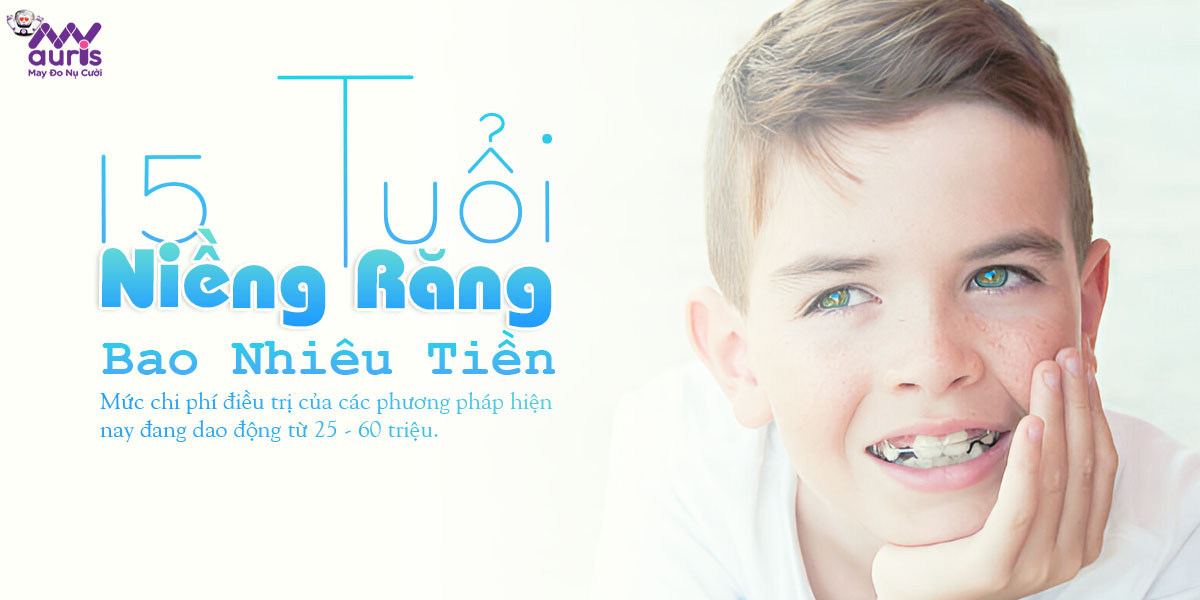 15 tuổi niềng răng bao nhiêu tiền