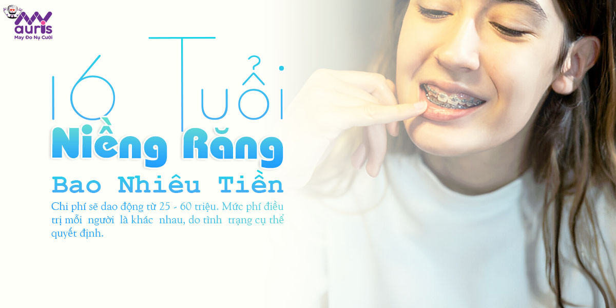 16 tuổi niềng răng bao nhiêu tiền