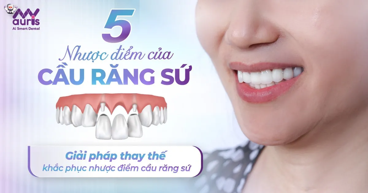 5 nhược điểm của cầu răng sứ - Giải pháp thay thế