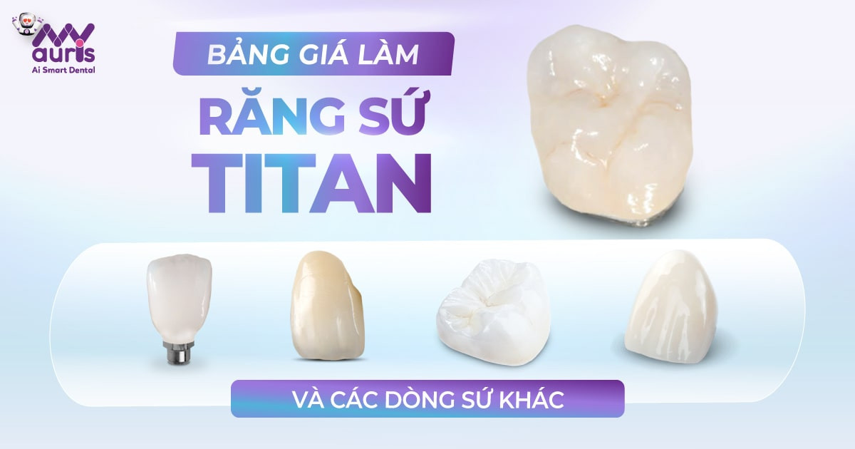 Bảng giá làm răng sứ titan và các dòng sứ khác