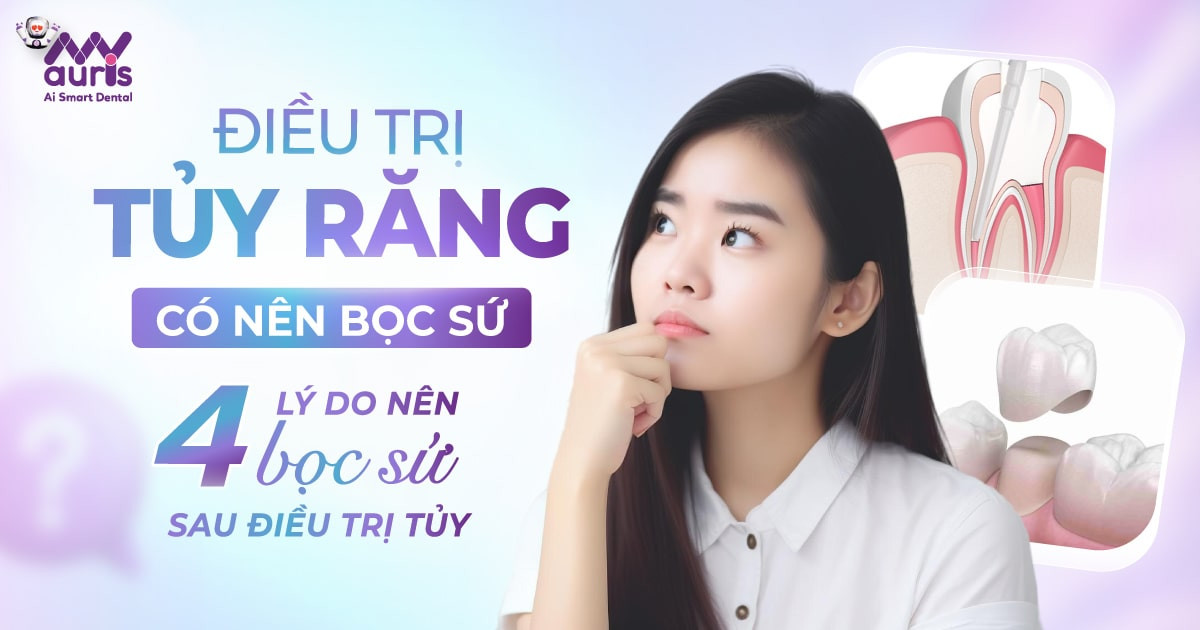 Điều trị tủy răng có nên bọc sứ - 4 lý do nên bọc sứ