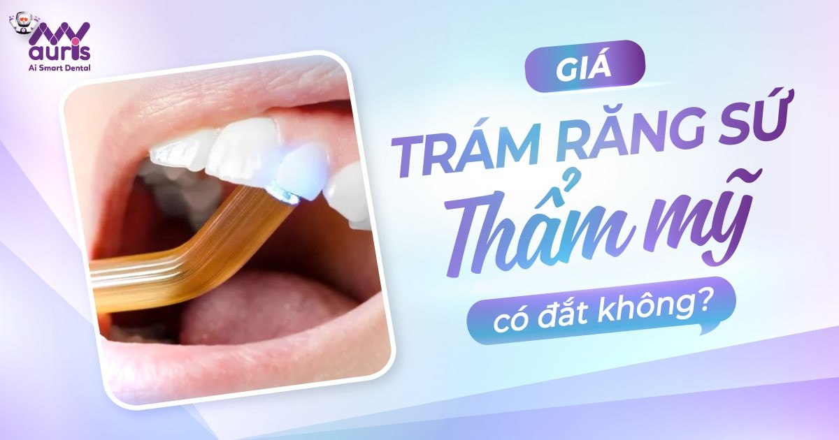 Giá trám răng sứ thẩm mỹ có đắt không