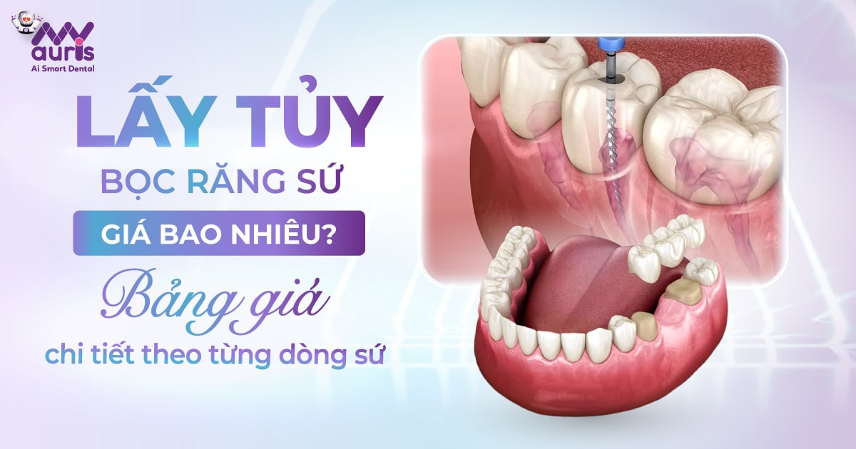 Lấy tủy bọc răng sứ giá bao nhiêu Giá mới nhất chi tiết