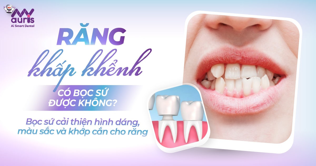 [GIẢI ĐÁP] Răng khấp khểnh có bọc sứ được không?