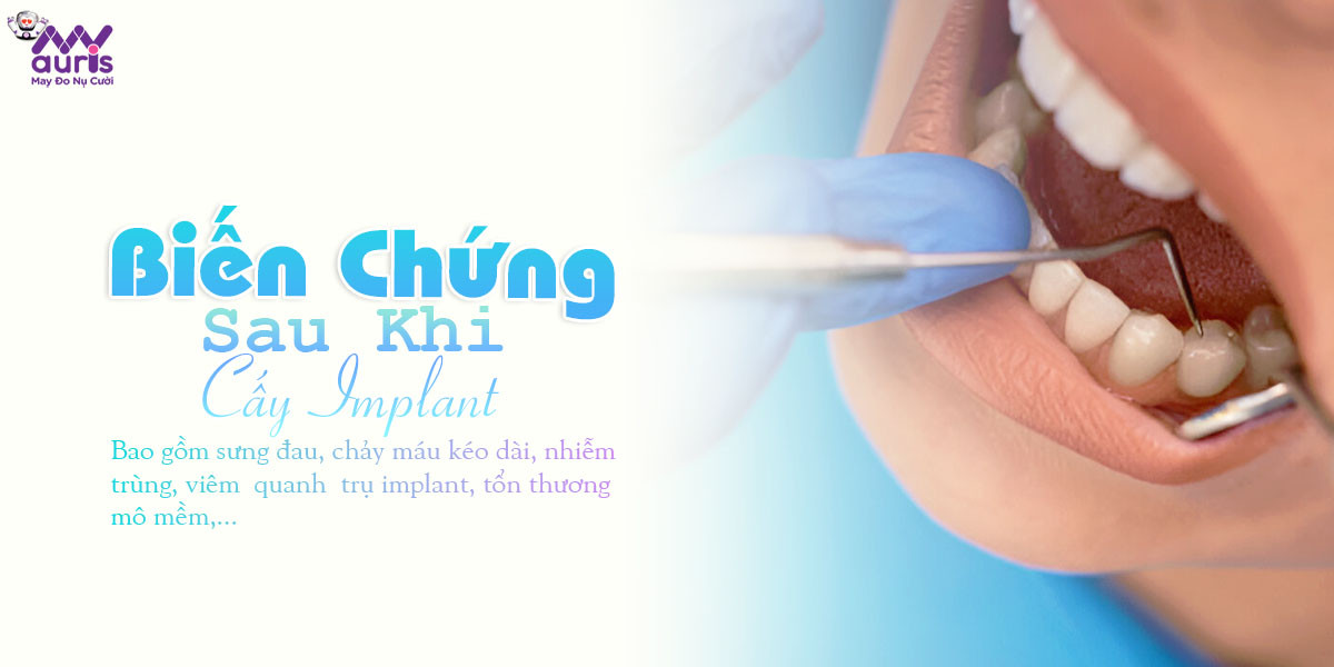 các biến chứng sau khi cấy implant