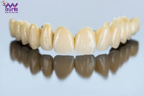 Răng sứ kim loại - Dòng răng được sử dụng rộng rãi