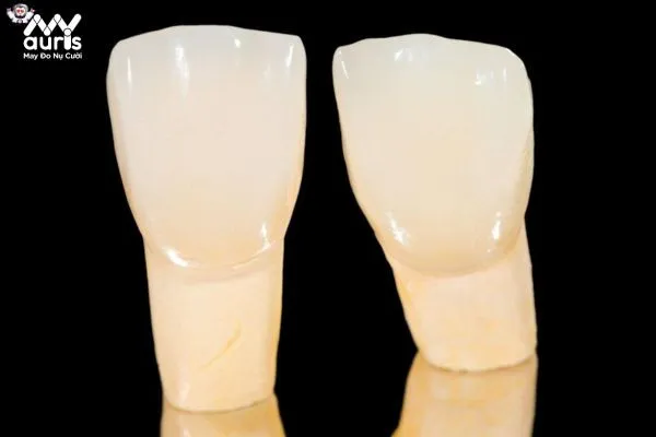 Răng sứ toàn sứ - Dòng răng phục hình an toàn 