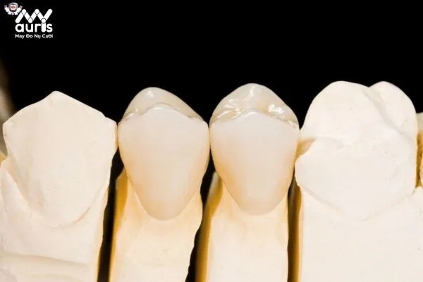 Vậy bọc răng sứ loại nào tốt?