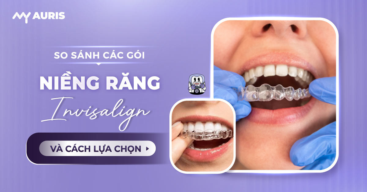 cac-goi-nieng-rang-invisalign-22-2-25