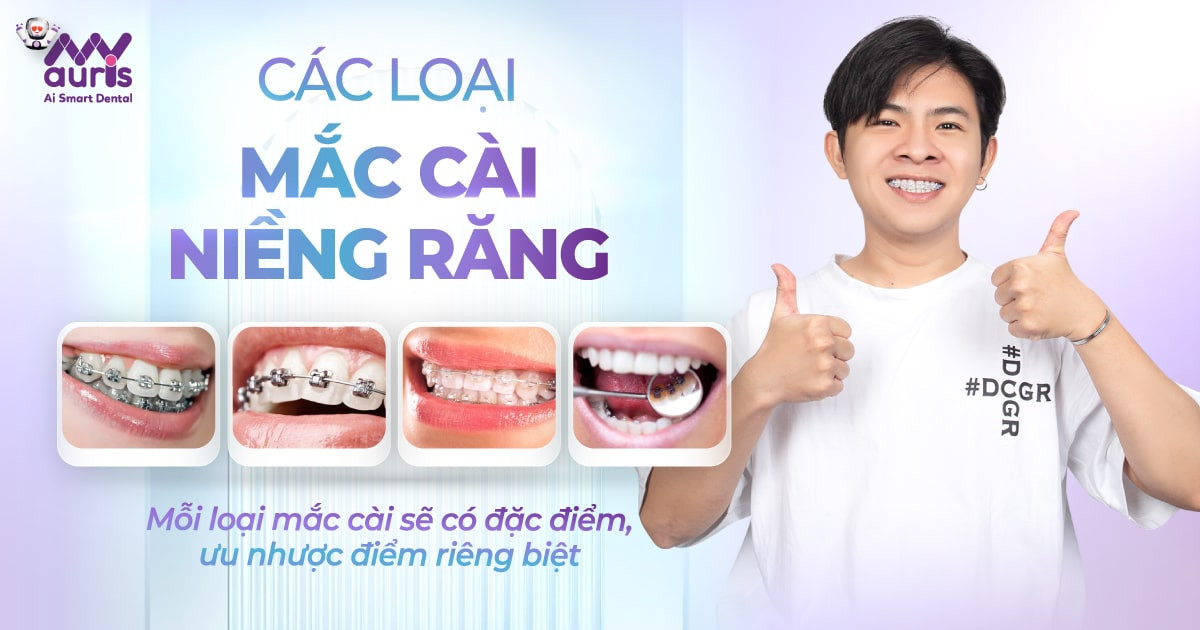 Các loại mắc cài niềng răng