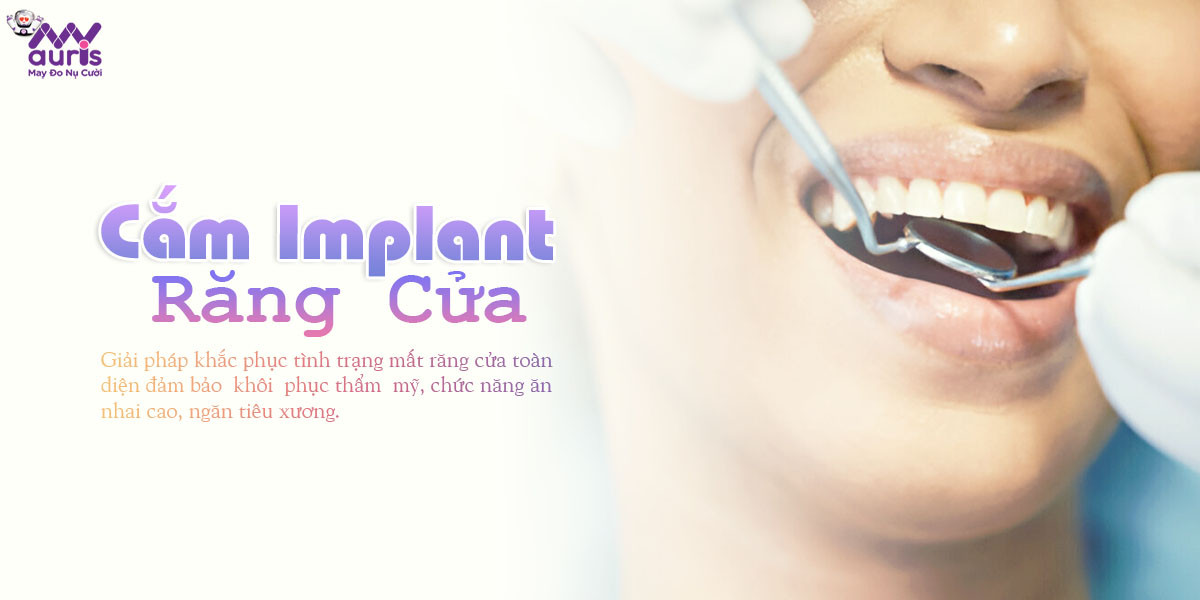 cắm implant răng cửa