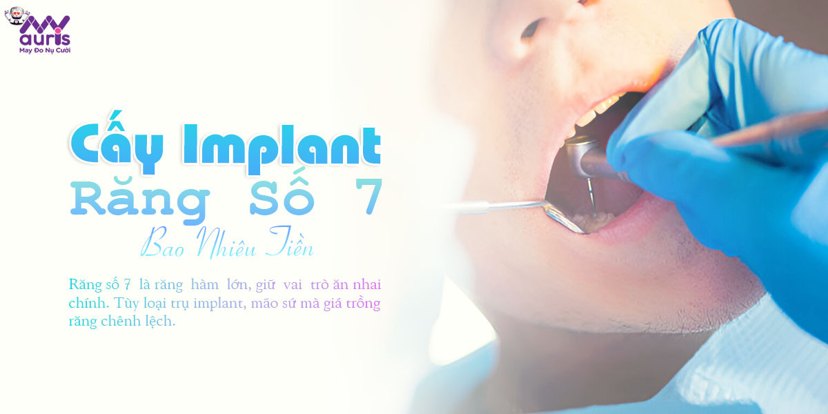 cấy implant răng số 7 bao nhiêu tiền