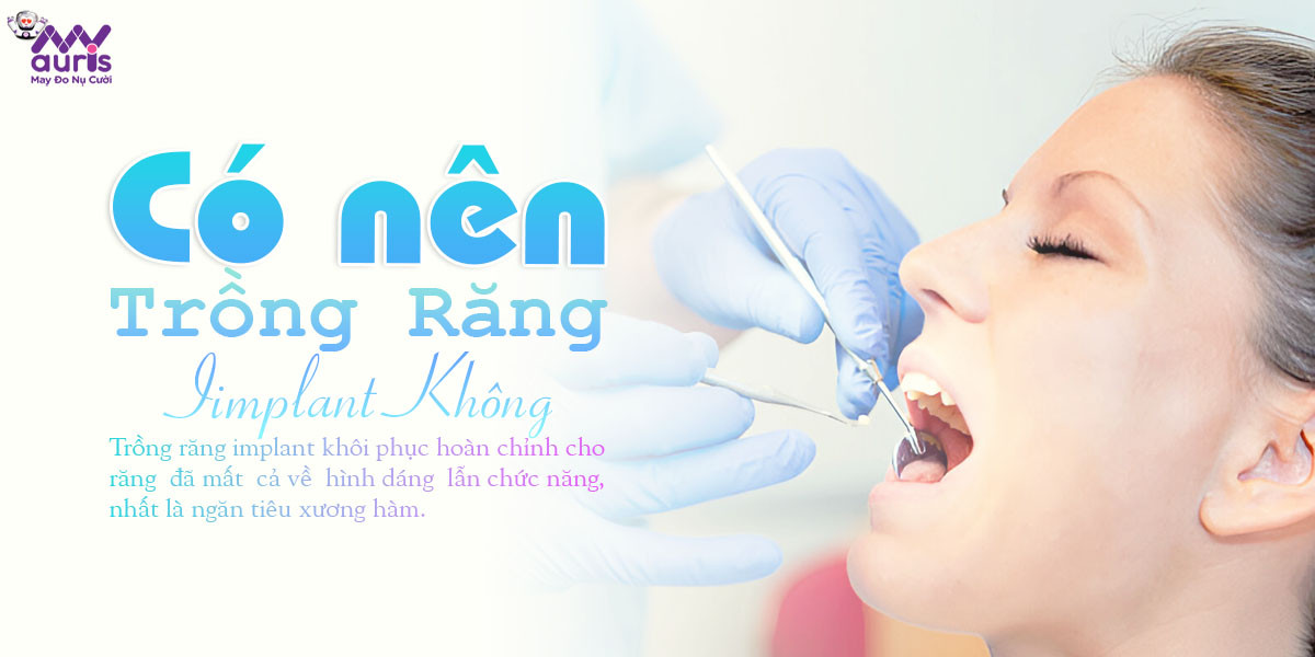 có nên trồng răng implant không