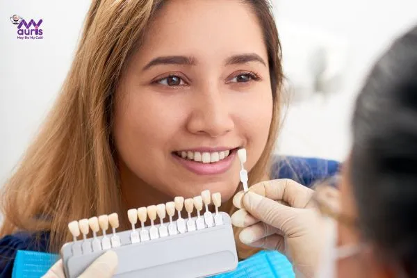 quy trình dán răng sứ veneer