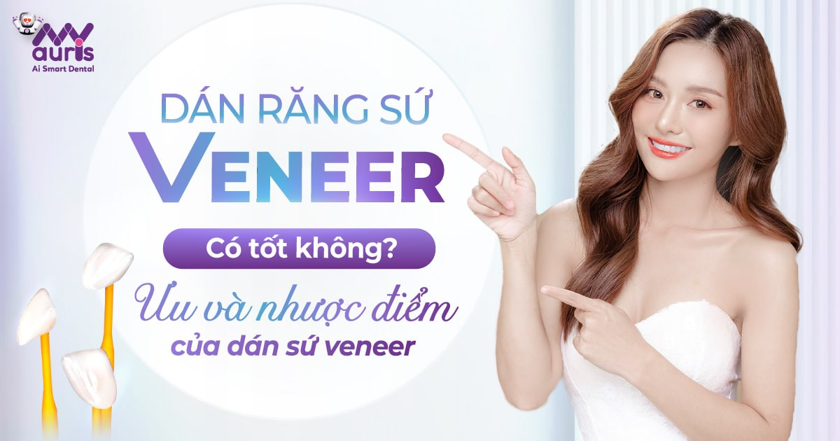 Dán răng sứ veneer có tốt không