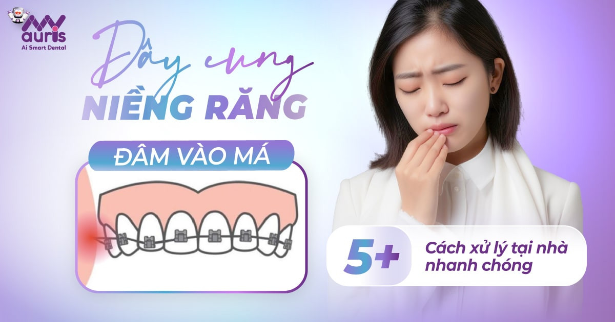 Dây cung niềng răng đâm vào má