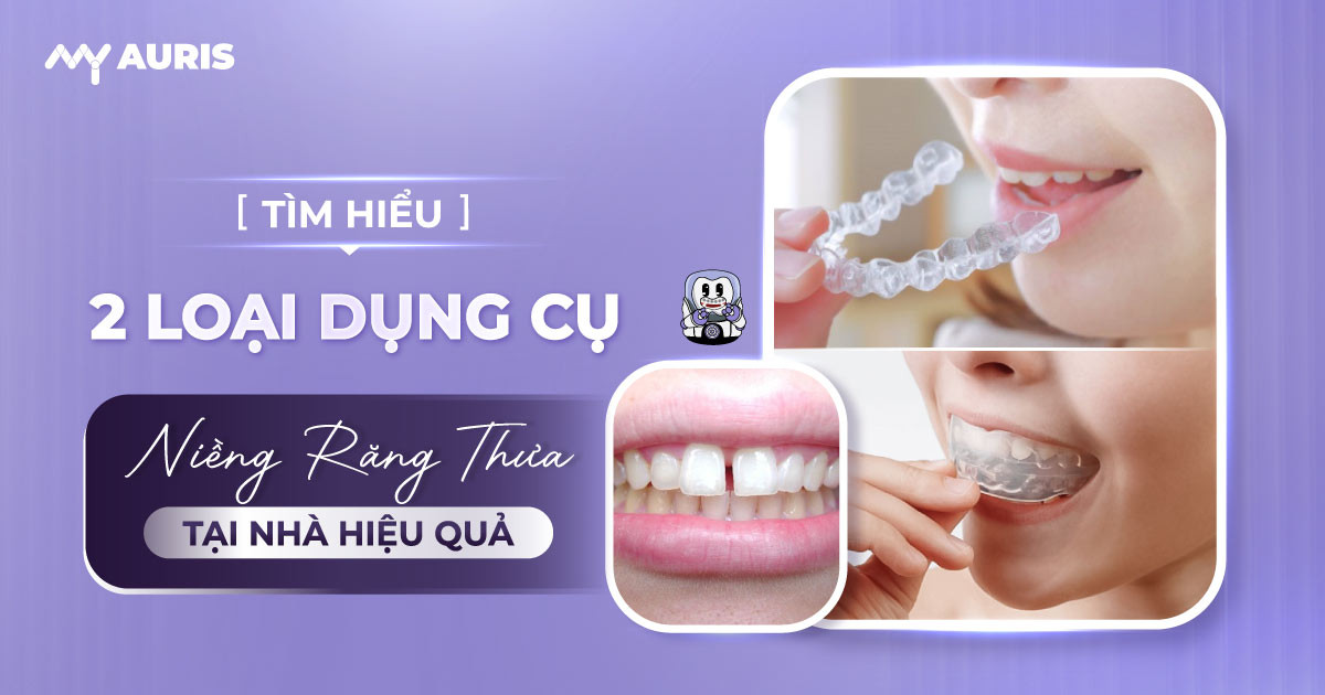 dụng cụ niềng răng thưa tại nhà,niềng răng thưa tại nhà