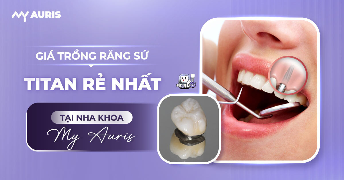 giá răng sứ titan,giá làm răng sứ titan,giá răng sứ titan đức,giá trồng răng sứ titan