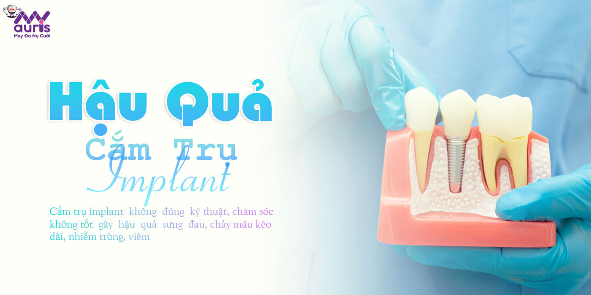 hậu quả của việc cắm trụ implant