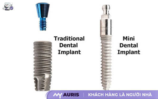 implant-mini-14-4-25-01