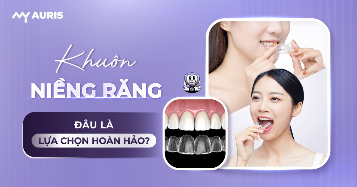 khuôn niềng răng,niềng răng bằng khuôn