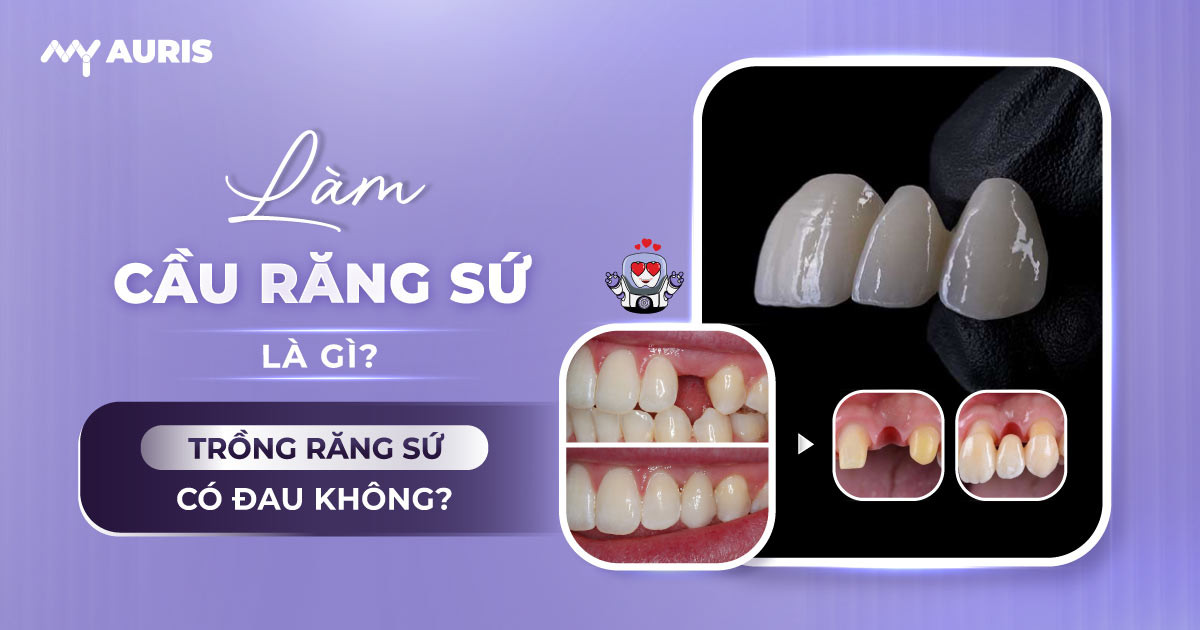 lam-cau-rang-su-co-dau-khong-1-3-25