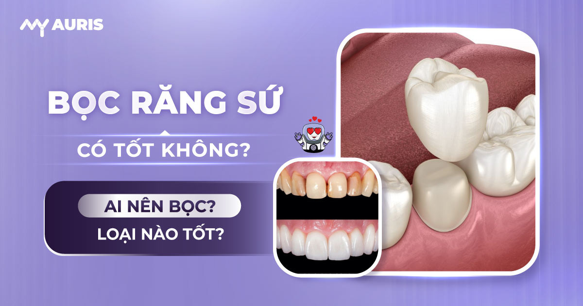 làm răng sứ có tốt không
