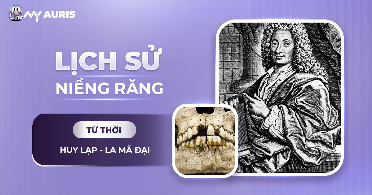 lịch sử niềng răng