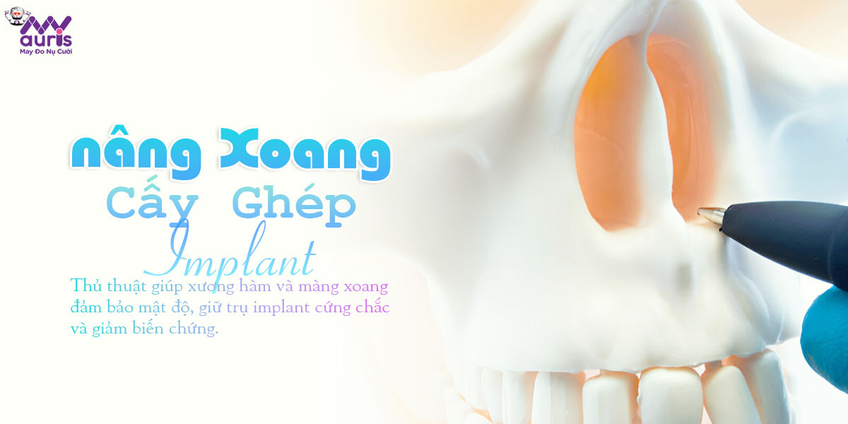 nâng xoang trong cấy ghép implant