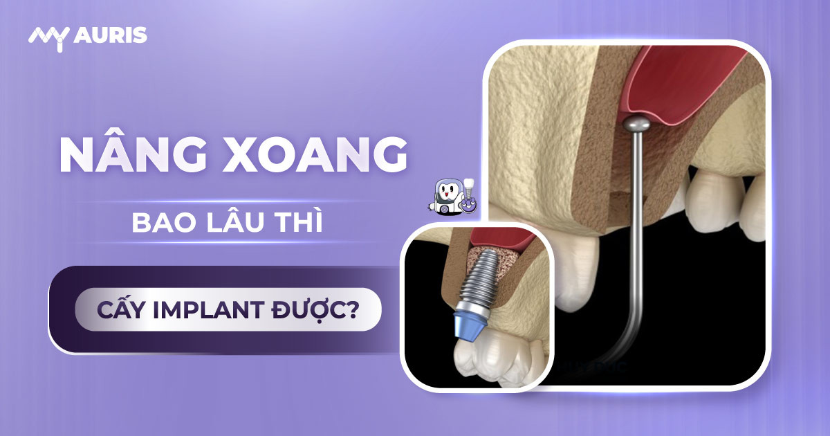 nâng xoang cấy implant,nâng xoang kín trong cấy implant