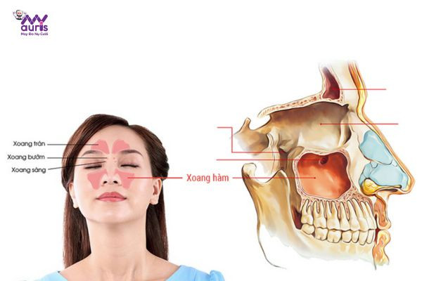  nâng xoang trong cấy ghép implant 