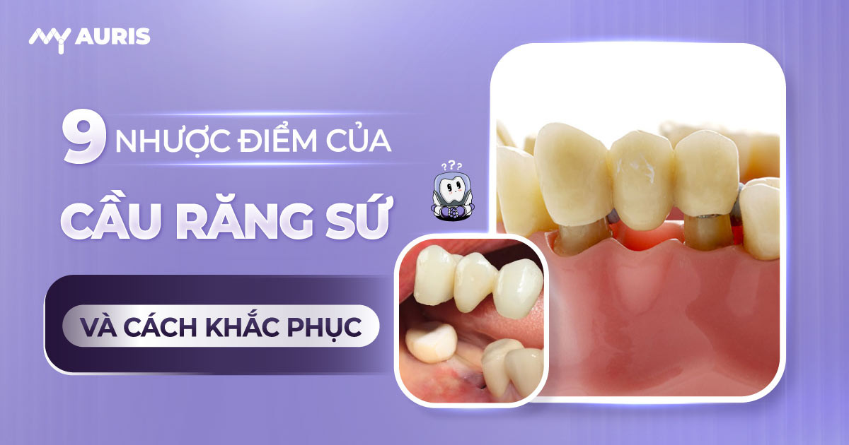 nhược điểm của cầu răng sứ