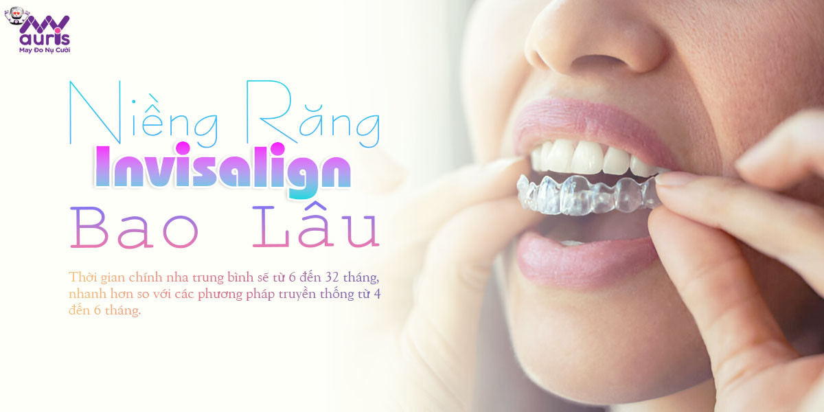 niềng răng Invisalign bao lâu