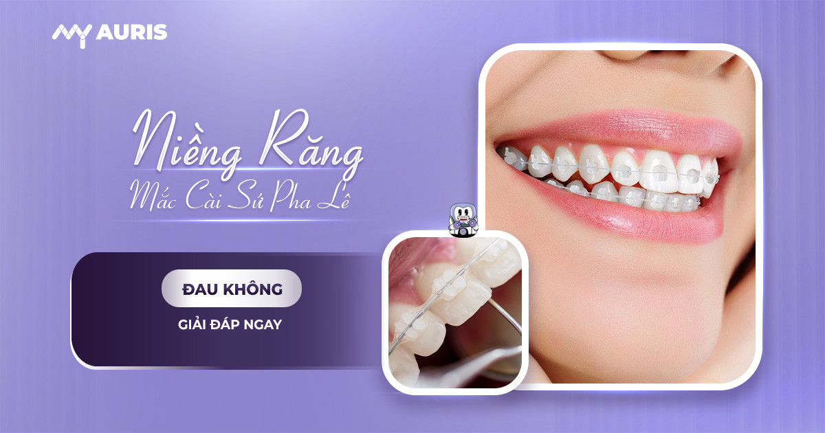 niềng răng mắc cài pha lê,niềng răng pha lê