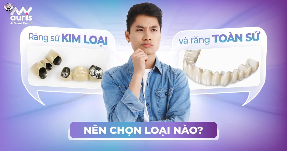 Răng sứ kim loại và răng toàn sứ