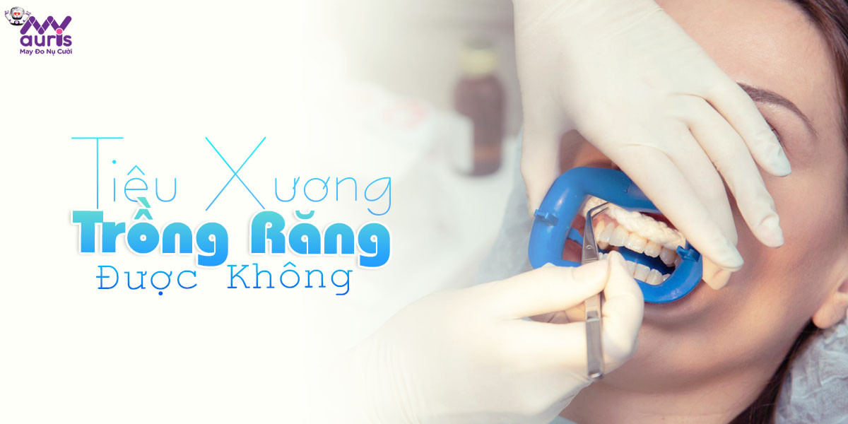 tiêu xương hàm có trồng răng được không